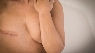 Cancer du sein : comment mieux accompagner les femmes dans la reconstruction mammaire ?