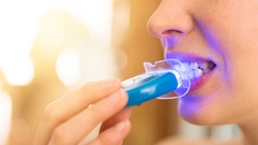 Blanchiment dentaire avec une lampe à LED : quels sont les risques ?
