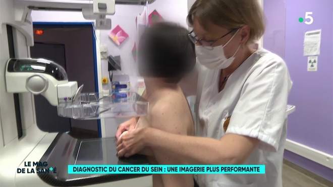 Diagnostic du cancer du sein : une imagerie plus performante