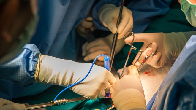 La nouvelle transplantation a eu lieu sur un homme de 57 ans en état de mort cérébrale, qui a fait don de son corps à la science. 