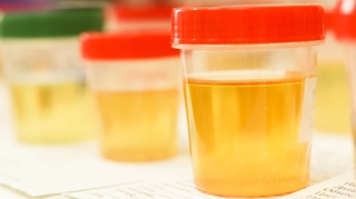 Comment votre urine pourrait devenir l'engrais de demain ?
