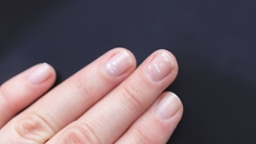 Quelle est la cause des taches blanches sur les ongles ?