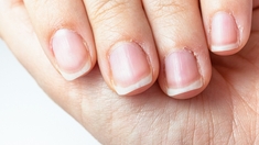 Petites peaux autour des ongles : ce qu'il faut faire et ne pas faire
