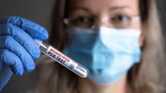 Flambée de mpox : faut-il craindre un retour de la variole du singe ?