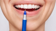 Comment faire disparaître les taches blanches sur les dents ?
