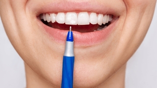 Comment faire disparaître les taches blanches sur les dents ?