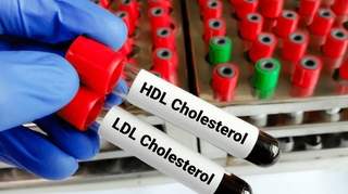 Peut-on avoir trop de "bon" cholestérol ?