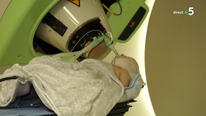 Une radiothérapie plus précise pour préserver le cerveau des enfant