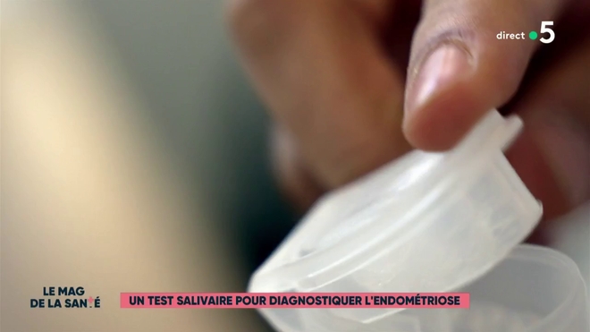 Un test salivaire pour diagnostiquer l'endométriose