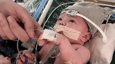 Succès pour la première transplantation partielle d'un coeur chez un nouveau-né