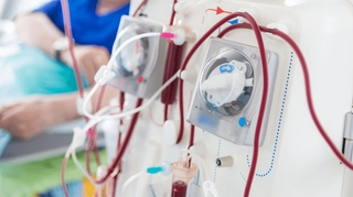 Insuffisance rénale : à quoi sert la dialyse ?