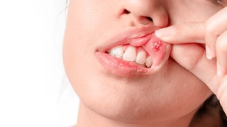 Pathologies de la bouche : quelles solutions ? - AlloDocteurs