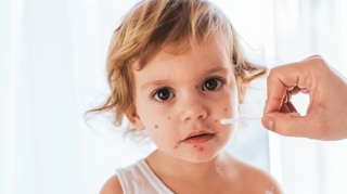Contagion, symptômes, guérison… comment reconnaître la varicelle ?