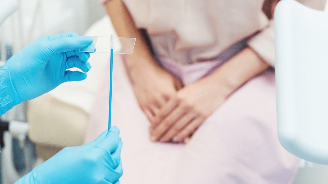 Âge, fréquence, autoprélèvement on vous dit tout sur les frottis et le test HPV AlloDocteurs