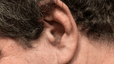 Laser, cire,épilation... comment enlever les poils dans les oreilles
