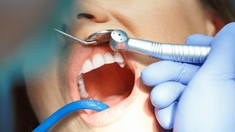 Carie : comment se passe la dévitalisation d’une dent ?