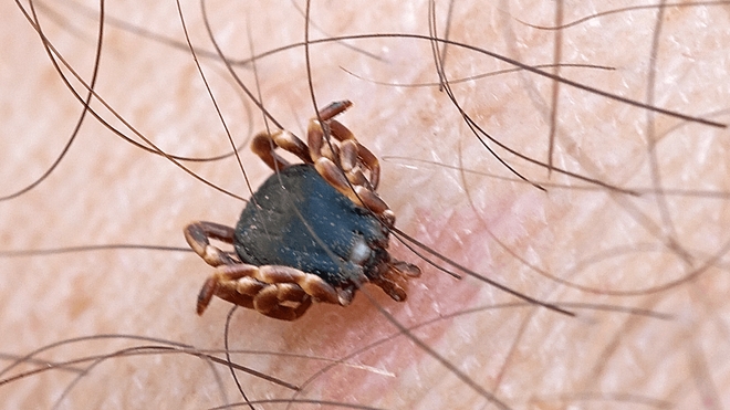 La tique géante est vectrice de maladies comme Lyme ou la fièvre hémorragique de Crimée-Congo