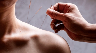 Acupuncture, hypnose, qi gong... quels bienfaits en cancérologie ?