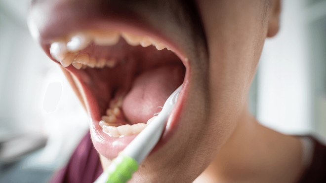 Si possible, privilégiez un brossage des dents régulier et une bonne hygiène bucco-dentaire