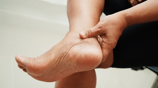 Comment soigner les crevasses aux pieds ?