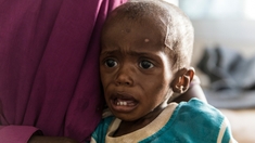 Madagascar : la malnutrition des enfants pourrait quadrupler