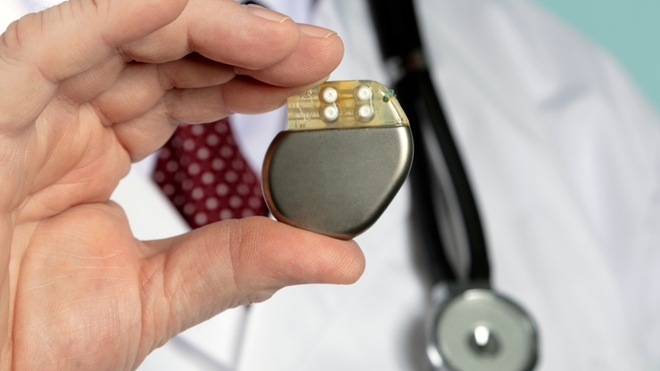 De nombreux Tchadiens pourront améliorer le suivi de leur pacemaker (photo d'illustration)