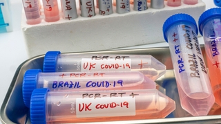 Covid-19 : Vers un changement des noms des variants ?