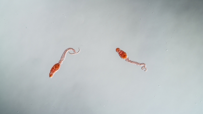 La bilharziose est provoquée par des vers parasites appelés schistosomes (photo d'illustration)