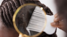 Poux : pour les cheveux afro, c'est un véritable casse-tête