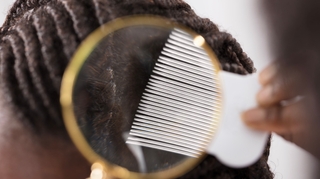 Poux : pour les cheveux afro, c'est un véritable casse-tête