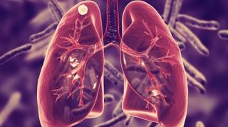 Le Covid-19 freine la lutte contre la tuberculose