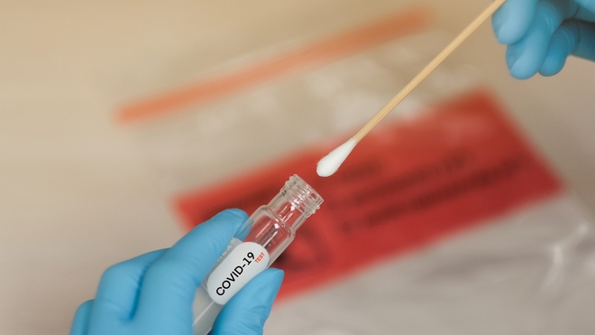 Un test du Coronavirus Covid-19 (Illustration)