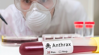 Burkina : deux morts après une contamination à l'anthrax