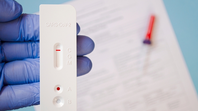 Les tests antigéniques sont disponibles à Libreville (image d'illustration)