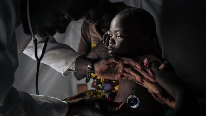 La rougeole fait à nouveau des ravages en RD Congo