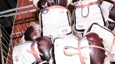 Coronavirus : face à la pénurie de sang, le Cameroun organise une grande collecte