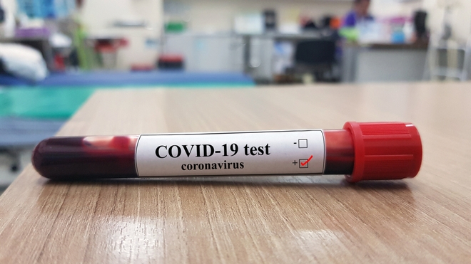 Les tests sérologiques sont enfin disponibles à l'Institut Pasteur de Tunis (photo d'illustration)