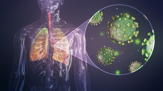 Cameroun : fermeture d'une clinique doualaise pour avoir dépisté le coronavirus avec un scanner thoracique