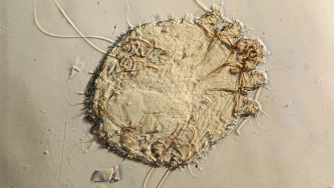 Voici le parasite à l'origine de la gale