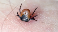 La maladie de Lyme : le mal de Justin Bieber existe-t-il en Afrique ?