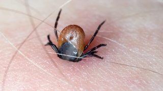 La maladie de Lyme : le mal de Justin Bieber existe-t-il en Afrique ?