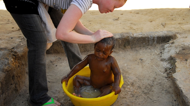 Au Tchad, les albinos ont difficilement accès aux soins de santé (Illustration)