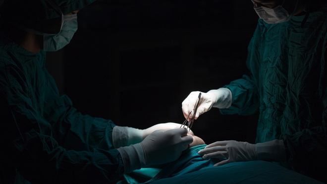 La liposuccion est l’opération esthétique la plus pratiquée dans le monde (Illustration)