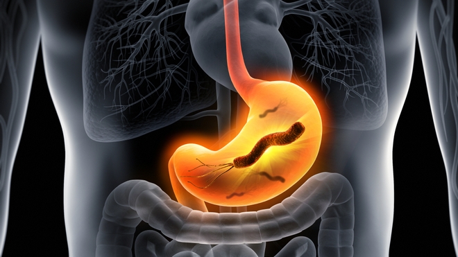L'helicobacter pylori est une bactérie qui est à l'origine des ulcères de l'estomac et des cancers gastriques