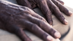 Un bracelet pour sauver les malades d'Alzheimer au Cameroun
