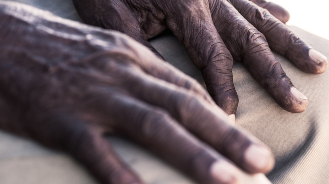 Les malades d'Alzheimer sont souvent pris pour des fous au Cameroun 