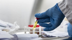 Covid-19 : au Sénégal, des tests de diagnostic rapide pour contrôler l'épidémie en Afrique