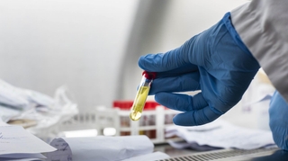 Covid-19 : au Sénégal, des tests de diagnostic rapide pour contrôler l'épidémie en Afrique