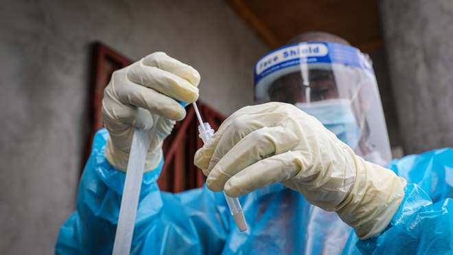 Les contaminations au Covid-19 semblent baisser ces derniers jours en Afrique