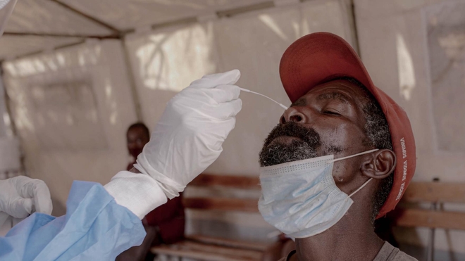 De nombreux pays africains ont du mal à effectuer des tests PCR en nombre suffisant pour contrôler la pandémie